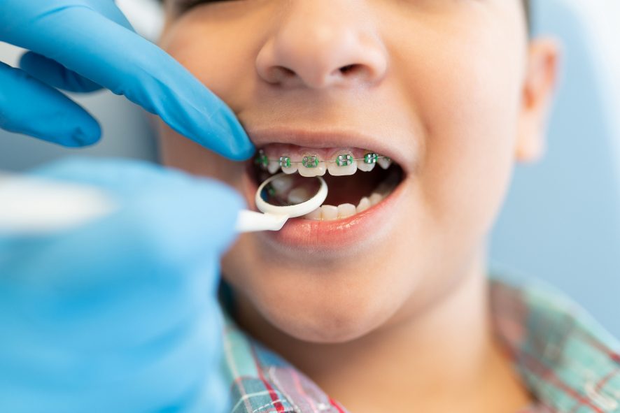 Child having a dental checkup
