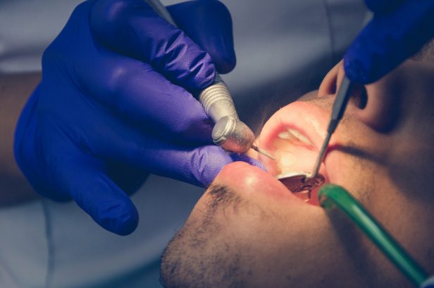 Dentist examining a patient's teeth