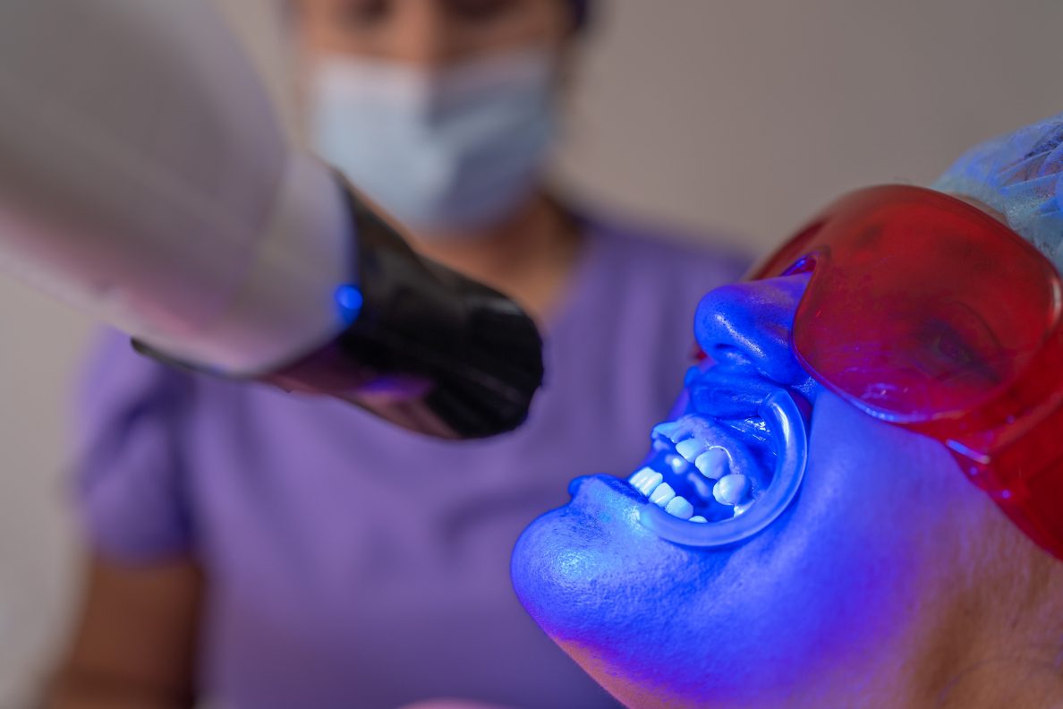 In-office teeth whitening with LED lamp